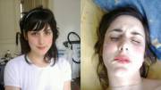 Before and after