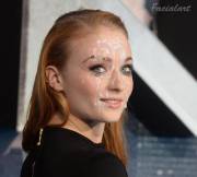 Sophie Turner facial [OC]