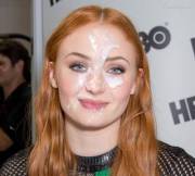 Sophie Turner facial [OC]