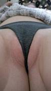 A [F]orgiving wedgie