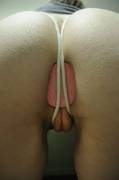 Pink plug held by ropes