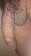 My resting, hairy penis