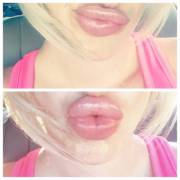 My bimbo's brand new 5cc dick sucking lips.