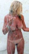 Sunburn