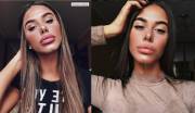 Bimbo lips