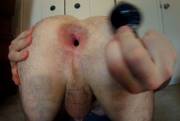 Post plug gape