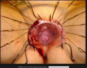"Hooker" Vagina