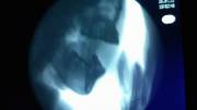 X-ray Blowjob