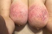 Just a sel[f]ie of my tits after some hard play tonight