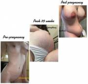 /u/kissmythong extreme post pregnancy BE