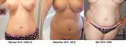 My near 100lb weight gain.