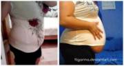 flat to fat
