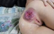 Totally wasted and destroyed Asshole [Pic]