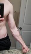 Recent weight loss is bringing the veins back