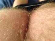 Hairy Humps