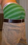 Sagging
