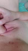First time posting something like this. Be nice. Made myself a little swollen 
