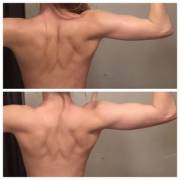 Jan 20 - March 28 Back Progress [f]