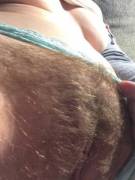 Hairy