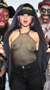 Selena Gomez xray