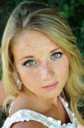 Freckles 
