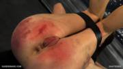 [F] Direct Hit