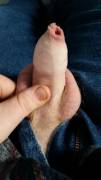 Do you like my foreskin?