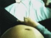 Growth/expansion tf GIF