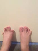 I did a quick manipulation of my feet turning into hooves. It's amateurish, but I think I did a good job :D