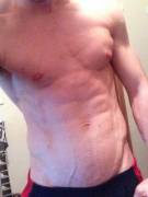 Second V Post (Ab veins)