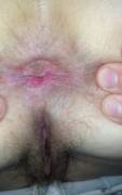 wife's hairy holes!!