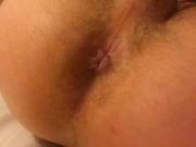 My hole
