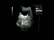 Sex in MRI